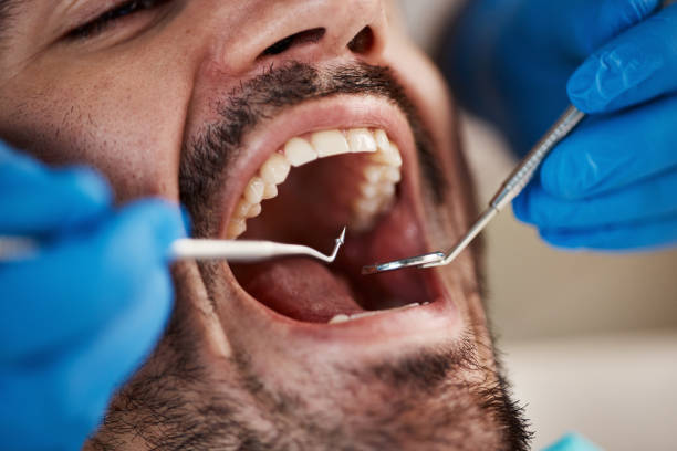 Best Emergency Broken Tooth Repair in Fort Totten, ND